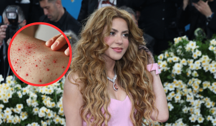 https://globonoticiasyucatan.com/investigan-posible-exposicion-masiva-a-sarampion-durante-concierto-de-shakira-en-new-york-globo-noticias-yucatan/